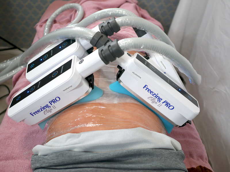 脂肪冷却 施術イメージ elise2