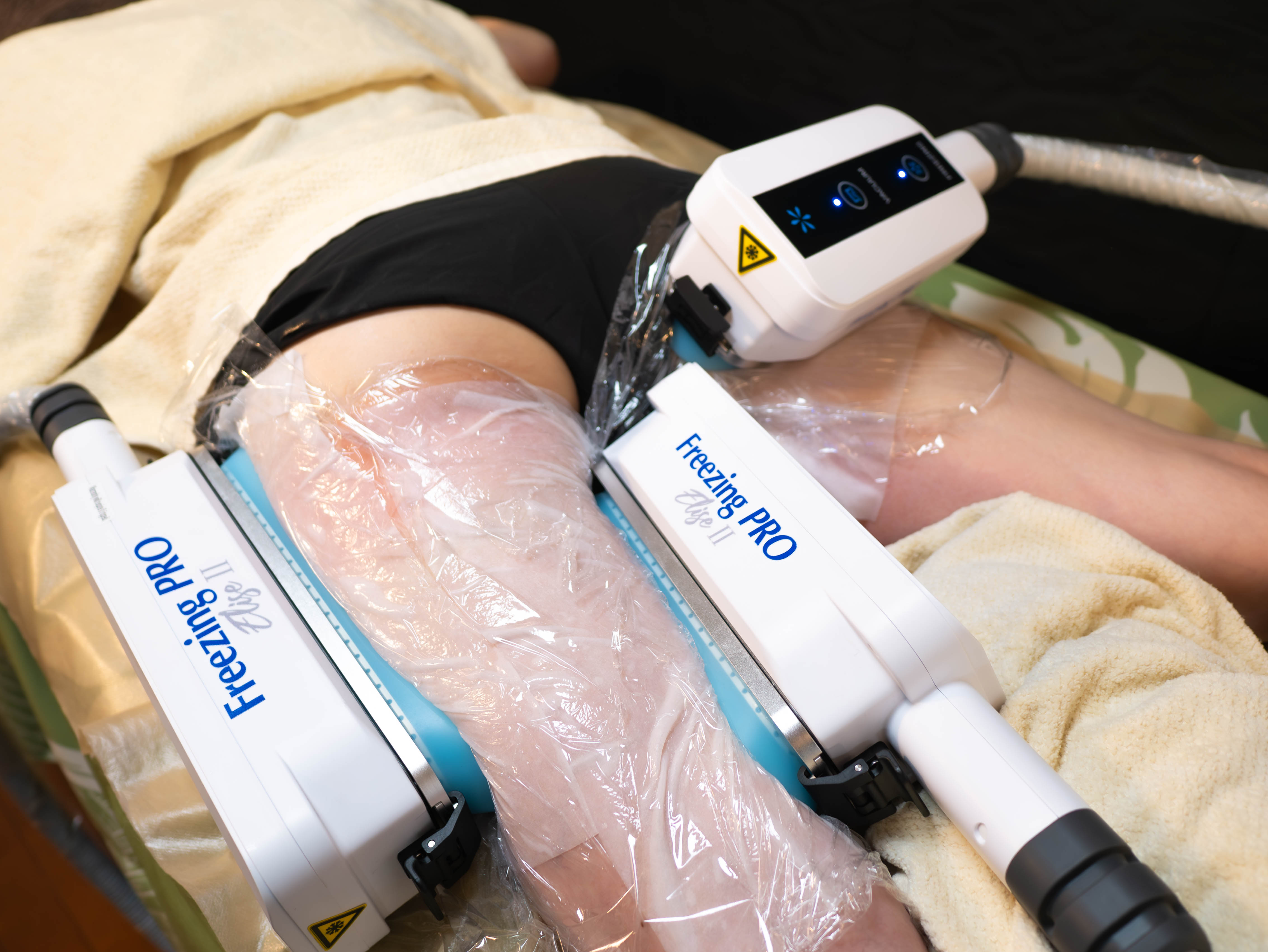 脂肪冷却 ボディケア 全身施術